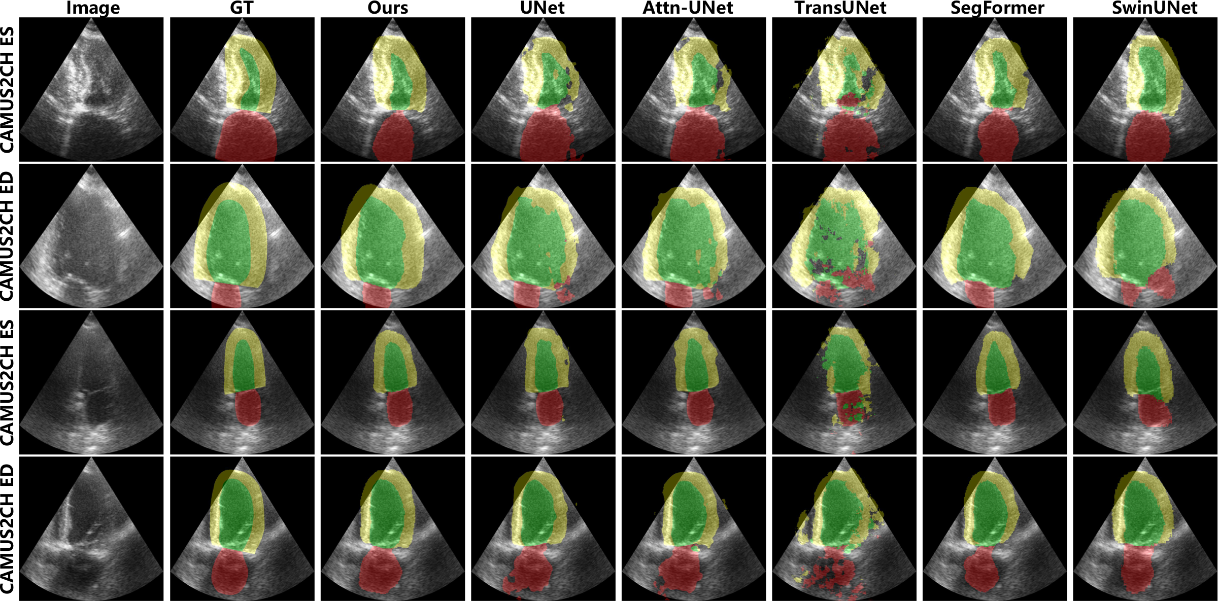 Segmentation visualization on CAMUS dataset in 2 chamber view