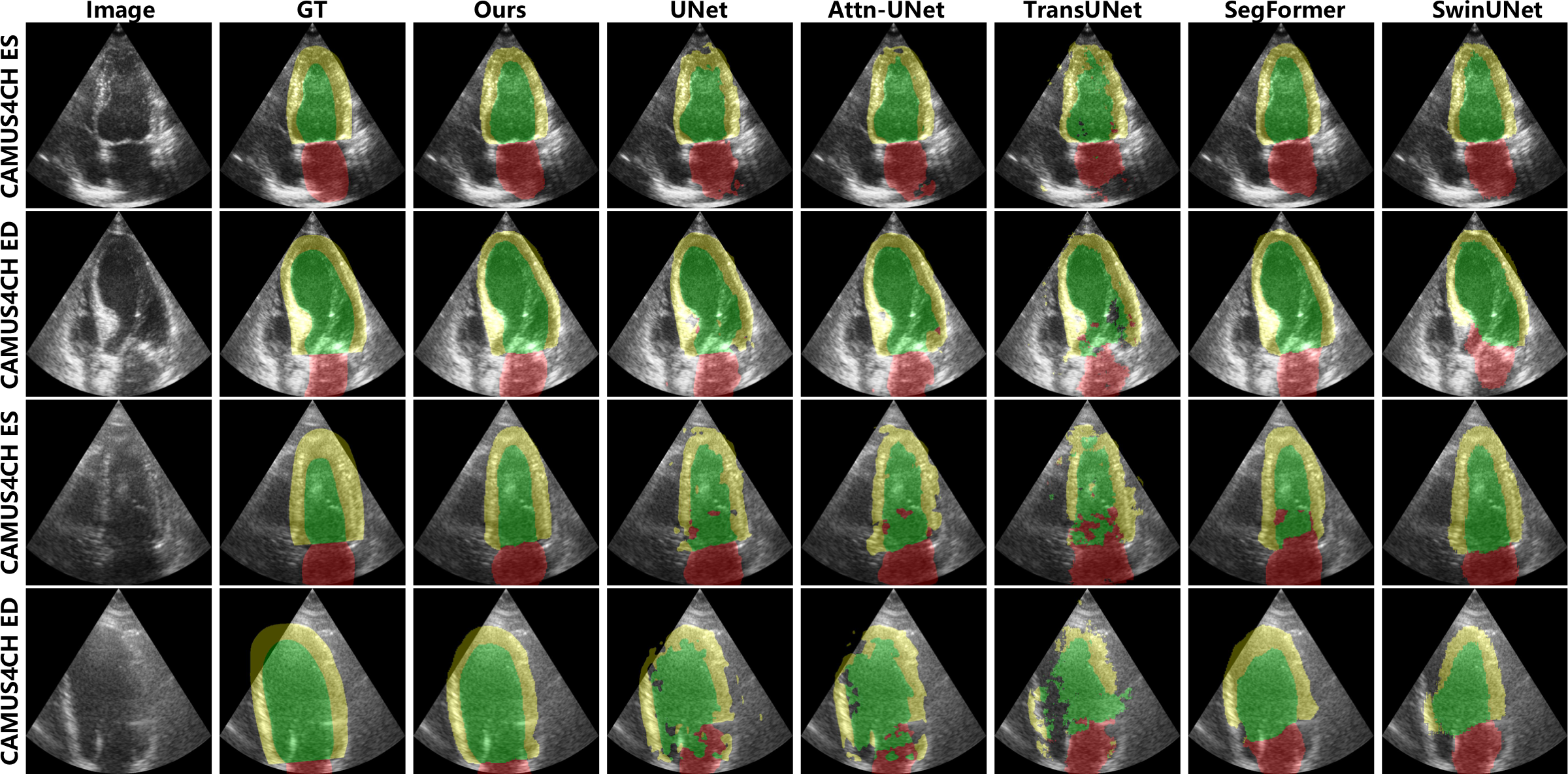 Segmentation visualization on CAMUS dataset in 4 chamber