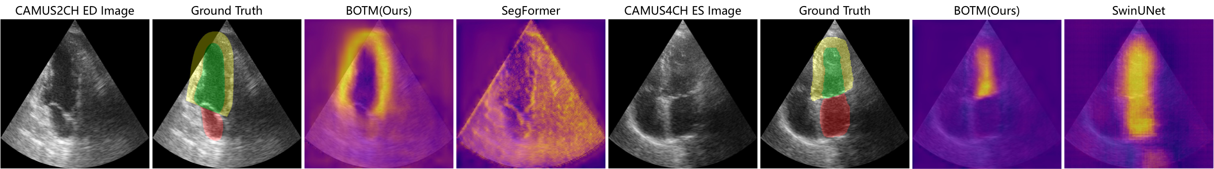 Segmentation uncertainty comparison showing BOTM reduces uncertainty